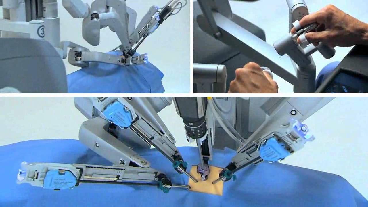 Robotic Precision in Joint Replacement Surgery: Redefining Success ...