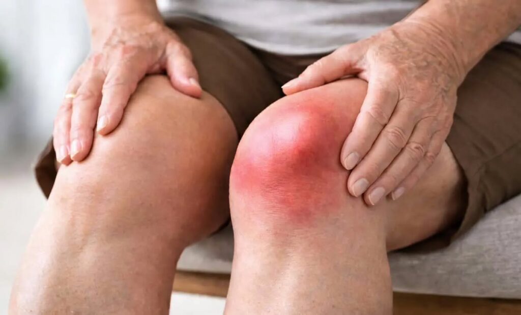 Woman experiencing knee stiffness and swelling while standing up from a chair.