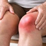 Woman experiencing knee stiffness and swelling while standing up from a chair.