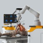 Orthopedic surgeon using robotic knee replacement technology for advanced joint replacement surgery.